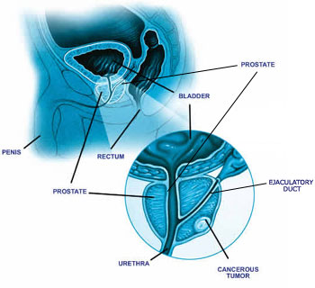 Prostate diagram.