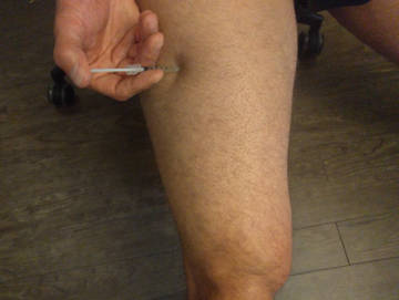 Thigh testosterone injection.